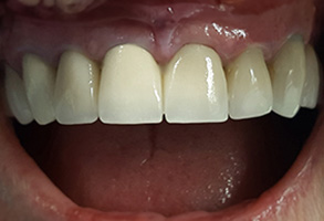  html    head  title 500 Internal Server Error  title   head    body    center  h1 500 Internal Server Error  h1   center    hr  center nginx 1.29.3  center     body     html 