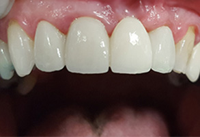  html    head  title 500 Internal Server Error  title   head    body    center  h1 500 Internal Server Error  h1   center    hr  center nginx 1.29.3  center     body     html 