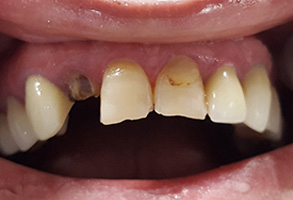  html    head  title 500 Internal Server Error  title   head    body    center  h1 500 Internal Server Error  h1   center    hr  center nginx 1.29.3  center     body     html 