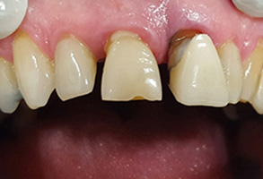  html    head  title 500 Internal Server Error  title   head    body    center  h1 500 Internal Server Error  h1   center    hr  center nginx 1.29.3  center     body     html 